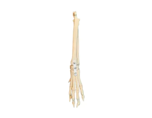 carpal-join1