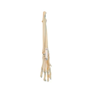 Carpal Joint Right - Image 1