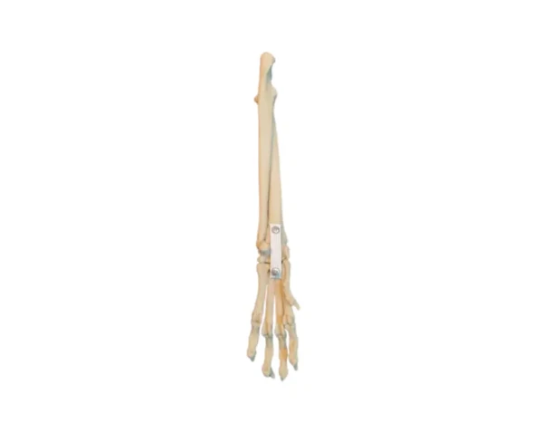 carpal-join3