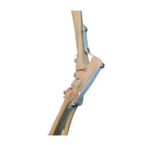Tarsal Joint Rigth - Image 2