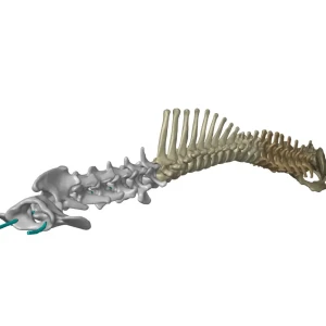 Spine - Image 8
