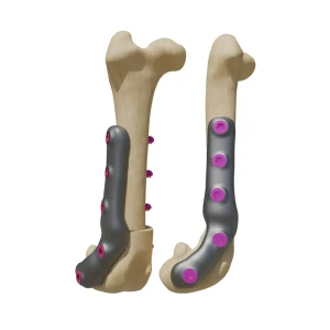 DFO - plate for correction of femoral deformities - Image 1