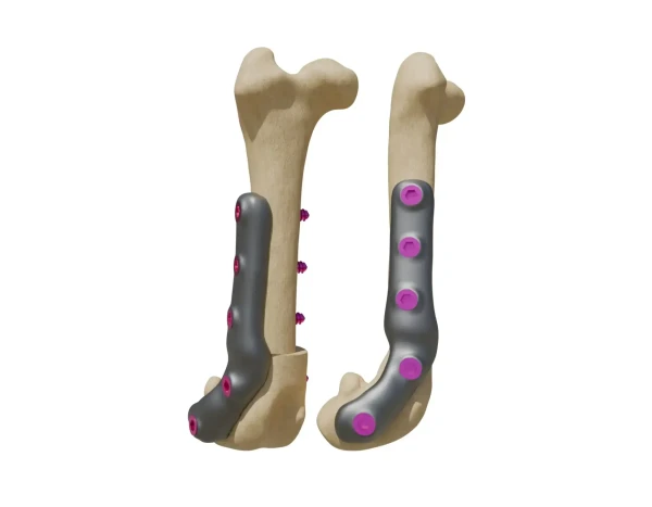 dfo-implant (1)