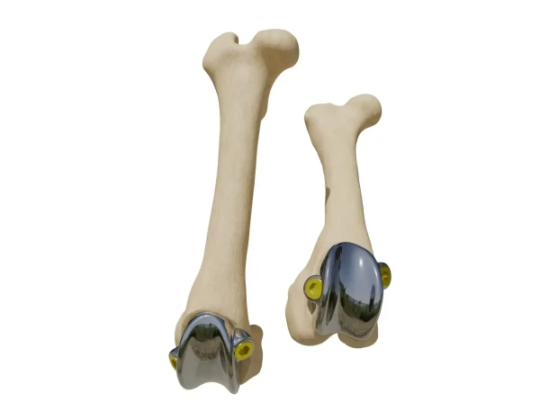 pgr-implant (1)