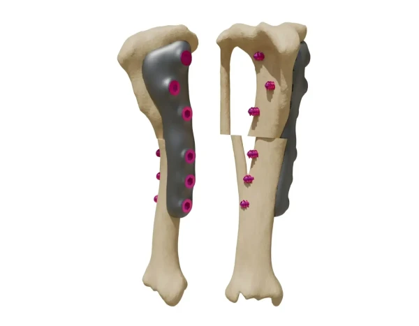 tpo-tplo-implant (1)
